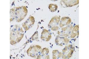 Immunohistochemistry of paraffin-embedded Human stomach using USH1C Polyclonal Antibody at dilution of 1:100 (40x lens). (USH1C 抗体)