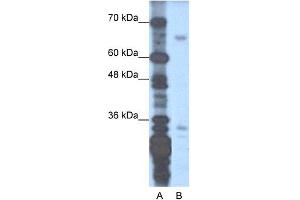WB Suggested Anti-ZNF691 Antibody Titration:  1. (ZNF691 抗体  (N-Term))