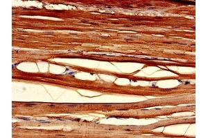 Immunohistochemistry of paraffin-embedded human skeletal muscle tissue using ABIN7147586 at dilution of 1:100 (CLIC2 抗体  (AA 53-247))
