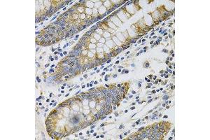 Immunohistochemistry of paraffin-embedded human colon using KRT20 Antibody.