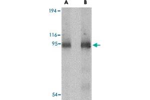 Western blot analysis of CD180 in human spleen tissue lysate with CD180 polyclonal antibody  at (A) 0. (CD180 抗体  (C-Term))