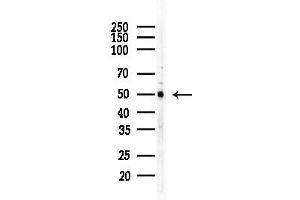 Western blot analysis of lysates from COLO205 cells(heat-shock,45 min treatment), using IFIB Antibody at 1/1000 dilution. (IFIT1B 抗体  (N-Term))