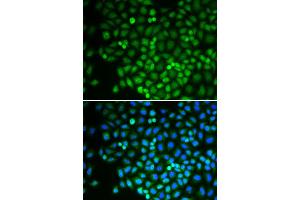 Immunofluorescence analysis of U2OS cell using POLR2D antibody.