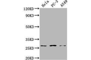 Western Blot Positive WB detected in: Hela whole cell lysate, PC-3 whole cell lysate, A549 whole cell lysate All lanes: RAB23 antibody at 1:2000 Secondary Goat polyclonal to rabbit IgG at 1/50000 dilution Predicted band size: 27 kDa Observed band size: 27 kDa (RAB23 抗体  (AA 18-234))