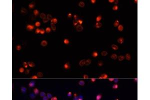 Immunofluorescence analysis of HeLa cells using AKT2 Polyclonal Antibody at dilution of 1:100. (AKT2 抗体)