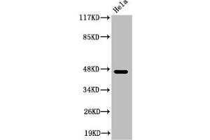 Western Blot analysis of HeLa cells using Cleaved-Plasma Kallikrein HC (R390) Polyclonal Antibody (KLKB1 抗体  (Cleaved-Arg390))