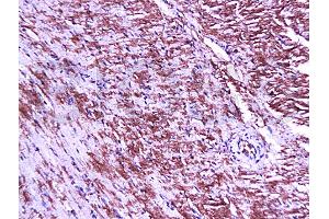 Formalin-fixed and paraffin embedded mouse heart tissue labeled Anti-Connexin-45 Polyclonal Antibody, Unconjugated (ABIN671466) at 1:200, followed by conjugation to the secondary antibody and DAB staining (GJC1 抗体  (AA 81-130))