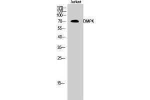 Western Blot (WB) analysis of Jurkat cells using DMPK Polyclonal Antibody. (DMPK 抗体  (N-Term))