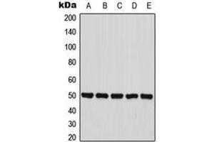 Western blot analysis of PANK2 expression in HepG2 (A), MCF7 (B), HT29 (C), mouse liver (D), PC12 (E) whole cell lysates. (PANK2 抗体  (Center))