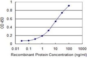 Detection limit for recombinant GST tagged ULK2 is 0. (ULK2 抗体  (AA 743-843))