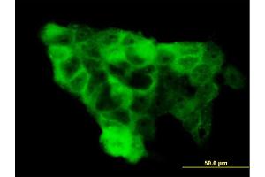 Immunofluorescence of monoclonal antibody to WWP1 on A-431 cell. (WWP1 抗体  (AA 152-260))