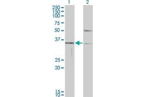 Western Blot analysis of HAVCR1 expression in transfected 293T cell line by HAVCR1 monoclonal antibody (M01), clone 1E5. (HAVCR1 抗体  (AA 23-122))