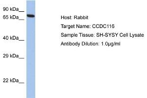Host: Rabbit Target Name: CCDC116 Sample Tissue: Human SH-SYSY Whole Cell  Antibody Dilution: 1ug/ml (CCDC116 抗体  (C-Term))