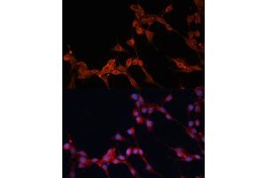 Immunofluorescence analysis of NIH/3T3 cells using SLC25 antibody (ABIN6128769, ABIN6147928, ABIN6147929 and ABIN6217136) at dilution of 1:100. (SLC25A38 抗体  (AA 140-220))