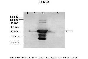 Western Blotting (WB) image for anti-Epilepsy, Progressive Myoclonus Type 2A, Lafora Disease (Laforin) (EPM2A) (N-Term) antibody (ABIN970635) (EPM2A 抗体  (N-Term))