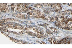 ABIN6279709 at 1/100 staining Human prostate tissue by IHC-P. (RABL5 抗体  (Internal Region))