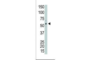 The anti-PRKCABP Pab (ABIN391108 and ABIN2841239) is used in Western blot to detect PRKCABP in Y79 cell lysate.