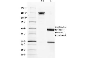 SDS-PAGE Analysis Purified CD137L-Monospecific Mouse Monoclonal Antibody (CD137L/1547). (TNFSF9 抗体)