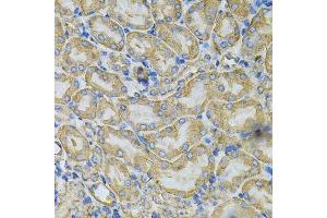 Immunohistochemistry (Paraffin-embedded Sections) (IHC (p)) image for anti-Heat Shock Protein 90kDa alpha (Cytosolic), Class B Member 1 (HSP90AB1) (AA 1-300) antibody (ABIN3021406)