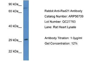 Western Blotting (WB) image for anti-RAD21 Homolog (RAD21) (N-Term) antibody (ABIN2786857) (RAD21 抗体  (N-Term))