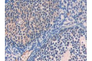 DAB staining on IHC-P; Samples: Mouse Ovary Tissue (Fetuin A 抗体  (AA 19-250))