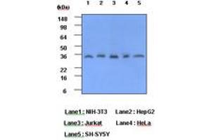 Image no. 1 for anti-C-Reactive Protein (CRP) (AA 19-224) antibody (ABIN6245663) (CRP 抗体  (AA 19-224))