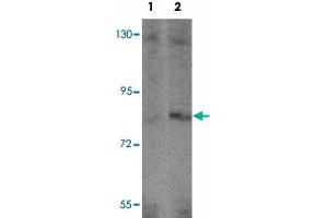 Western blot analysis of APBA2 in human brain tissue lysate with APBA2 polyclonal antibody  at (1) 1 and (2) 2 ug/mL. (APBA2 抗体  (Internal Region))