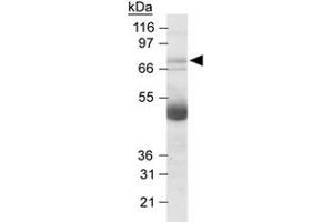 Western blot analysis of NOX4 in human kidney lysates with NOX4 polyclonal antibody at 2. (NADPH Oxidase 4 抗体  (AA 100-200))
