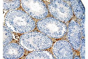 ABIN6262814 and ABIN6273131 at 1/100 staining Mouse testis tissue by IHC-P.