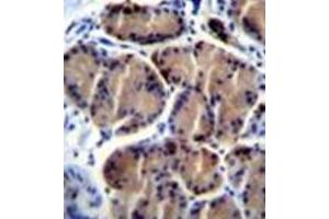 Immunohistochemistry analysis in formalin fixed and paraffin embedded human stomach tissue reacted with LIPC / Hepatic lipase (Center) followed by peroxidase conjugation of the secondary antibody and DAB staining. (LIPC 抗体  (Middle Region))