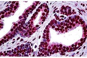 Human Prostate: Formalin-Fixed, Paraffin-Embedded (FFPE) (MEF2A 抗体  (AA 71-170))