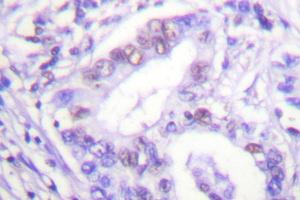 Image no. 1 for anti-Protein Inhibitor of Activated STAT, 4 (PIAS4) antibody (ABIN271954) (PIAS4 抗体)