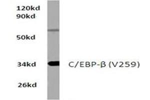 Image no. 1 for anti-CCAAT/enhancer Binding Protein (C/EBP), beta (CEBPB) antibody (ABIN272175) (CEBPB 抗体)