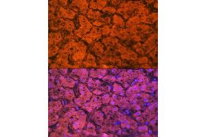 Immunofluorescence analysis of human liver using Hemopexin (HPX) (HPX) Rabbit mAb (ABIN7267611) at dilution of 1:100 (40x lens). (Hemopexin 抗体)