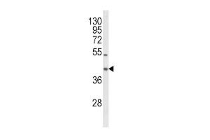 Western blot analysis of OLR1 Antibody (Center) (ABIN652795 and ABIN2842521) in HL-60 cell line lysates (35 μg/lane).