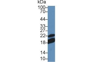 Western Blot; Sample: Mouse Lymph node lysate; Primary Ab: 5µg/ml Rabbit Anti-Mouse CD28 Antibody Second Ab: 0. (CD28 抗体  (AA 33-174))