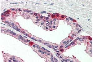 Human Prostate (formalin-fixed, paraffin-embedded) stained with TAOK3 antibody ABIN337220 at 1:5 followed by biotinylated anti-goat IgG secondary antibody ABIN481715, alkaline phosphatase-streptavidin and chromogen. (TAO Kinase 3 抗体  (AA 396-411))