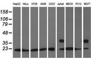 Western blot analysis of extracts (35 µg) from 9 different cell lines by using anti-ARHGDIA monoclonal antibody. (ARHGDIA 抗体)