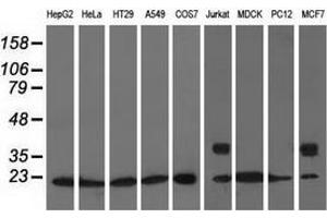Western blot analysis of extracts (35 µg) from 9 different cell lines by using anti-ARHGDIA monoclonal antibody.
