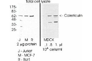 Image no. 1 for anti-Calreticulin (CALR) (C-Term) antibody (ABIN265295) (Calreticulin 抗体  (C-Term))