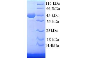 SDS-PAGE (SDS) image for Podocalyxin-Like (PODXL) (AA 23-461) protein (His tag) (ABIN7479144)