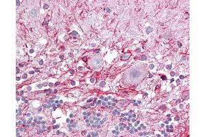 Anti-RP2 antibody IHC of human brain, cerebellum. (RP2 抗体  (C-Term))