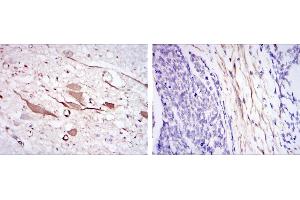 Immunohistochemical analysis of paraffin-embedded brain tissues (left) and esophageal cancer tissues (right) using HSP27 mouse mAb with DAB staining. (HSP27 抗体)