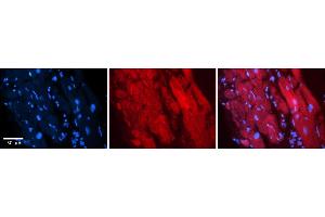 Immunohistochemistry (IHC) image for anti-Zinc Finger RNA Binding Protein (ZFR) (Middle Region) antibody (ABIN2775852)