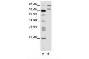 Image no. 1 for anti-Zinc Finger Protein 709 (ZNF709) (AA 61-110) antibody (ABIN202844) (ZNF709 抗体  (AA 61-110))