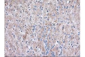 Immunohistochemical staining of paraffin-embedded Human liver tissue using anti-BTK mouse monoclonal antibody. (BTK 抗体)
