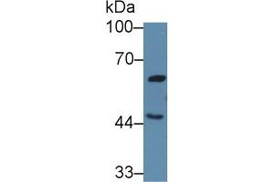 Western blot analysis of Human 293T cell lysate, using Human GHRHR Antibody (3 µg/ml) and HRP-conjugated Goat Anti-Rabbit antibody ( (GHRHR 抗体  (AA 23-130))