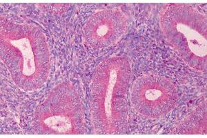 Human Endometrium: Formalin-Fixed, Paraffin-Embedded (FFPE) (PAK2 抗体  (C-Term))