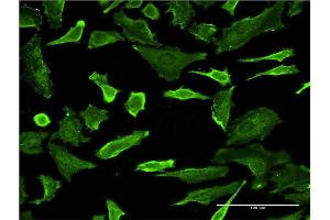Immunofluorescence (IF) image for anti-Cyclin-Dependent Kinase 16 (CDK16) (AA 1-80) antibody (ABIN518710)