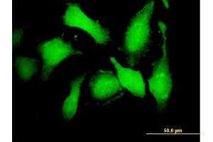 Immunofluorescence of purified MaxPab antibody to CDK5 on HeLa cell. (CDK5 抗体  (AA 1-292))